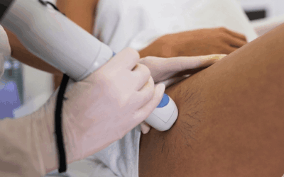 Everything to Know About Women’s Vascular Health