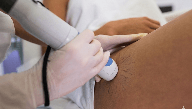 Everything to Know About Women’s Vascular Health